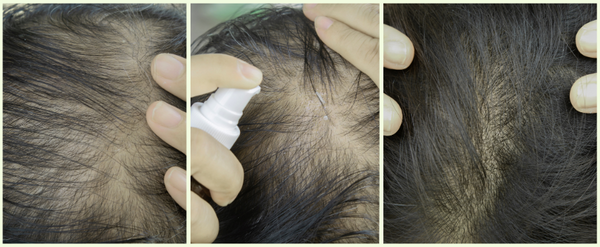 The Ultimate Guide to Using Beyond Hair Oil for Hair Growth
